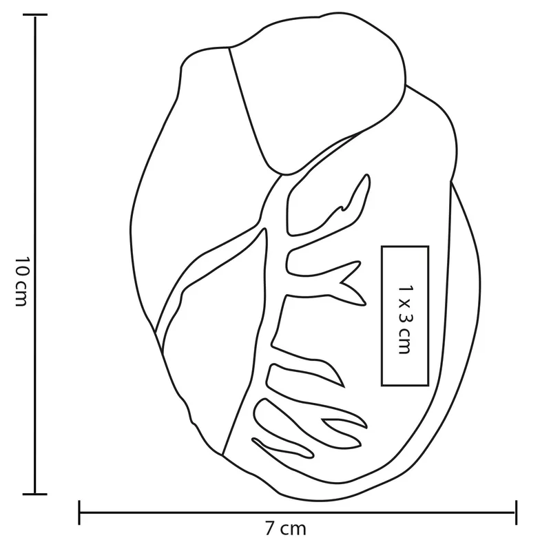 HEART 3